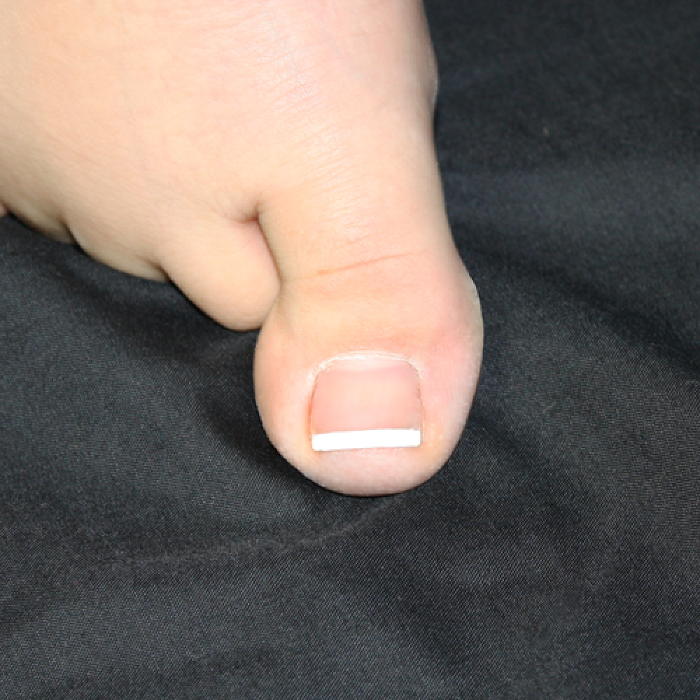 My toe word image